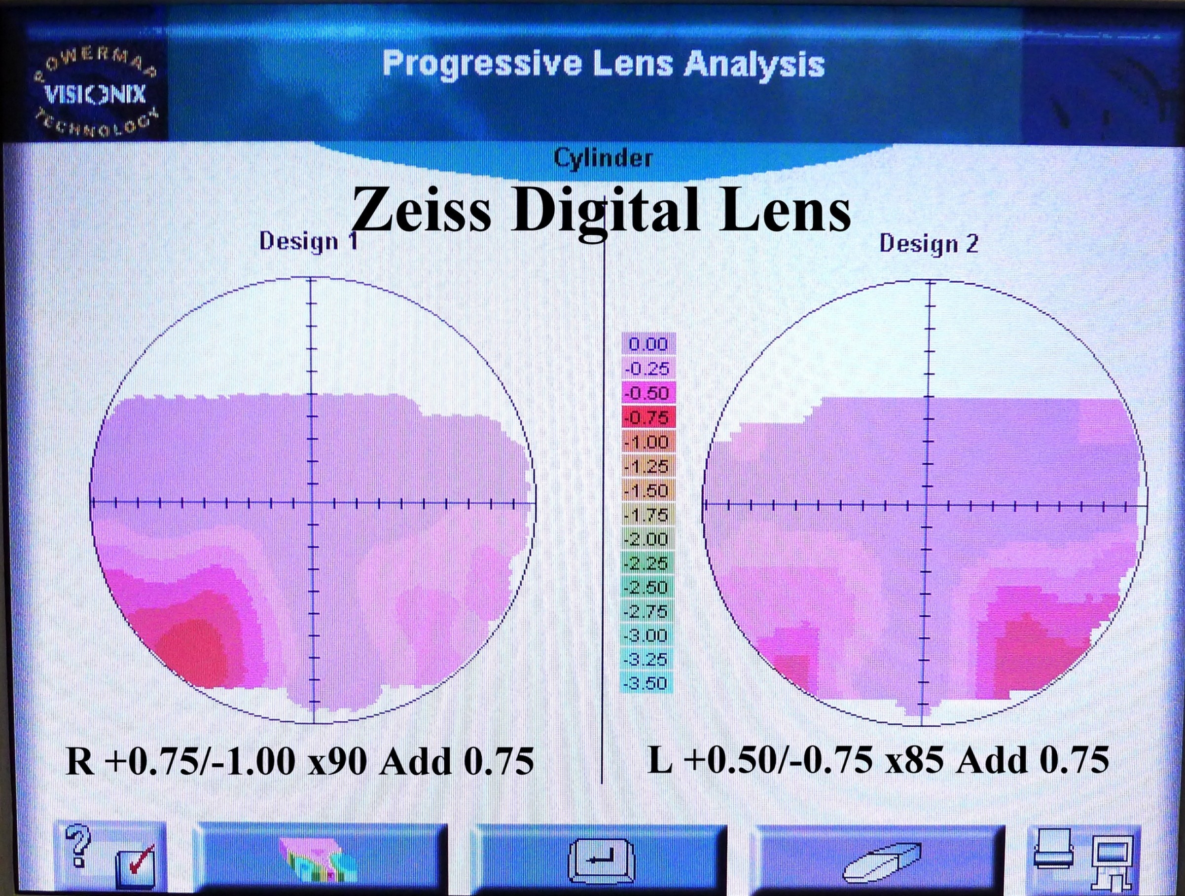 Standard Progressive Lens